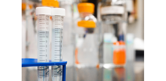 Two vials in a chemistry laboratory used for water quality testing